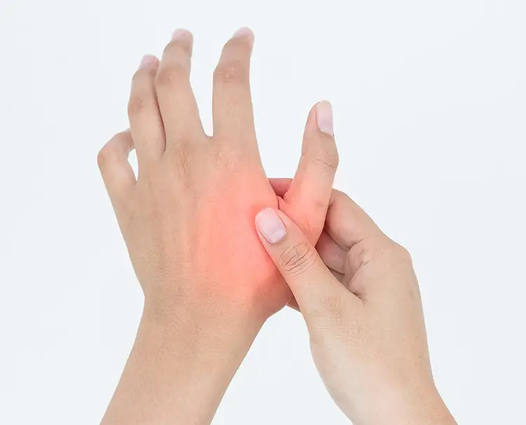 Arthrose Finger Schmerzhafte Fingergelenke Medizinmonitor